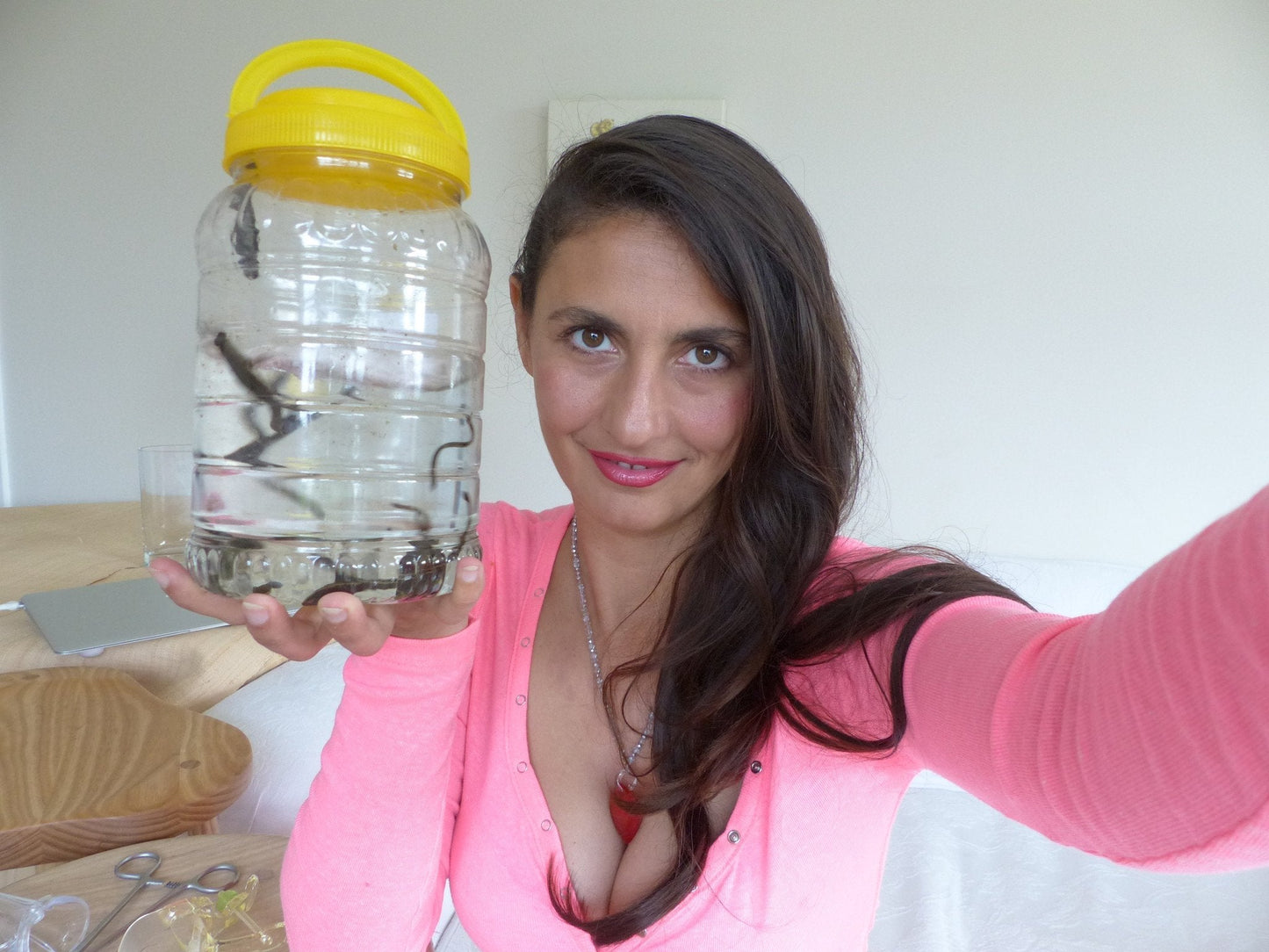 Leech Therapy Hirudotherapy in London, UK