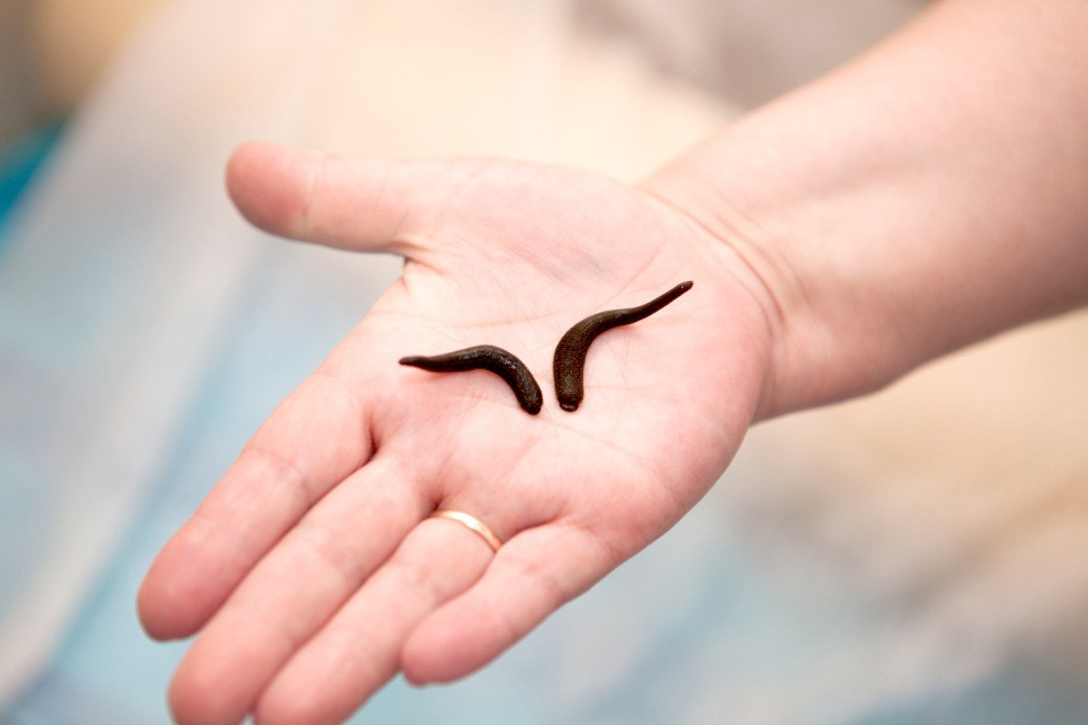 Couple Of Leeches Ready To Mate