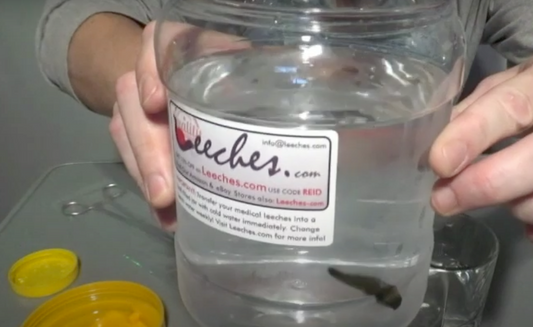 Leeches ???