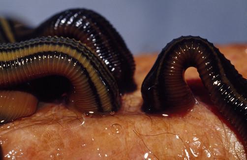 Order 3 Hirudo Leeches in Canada